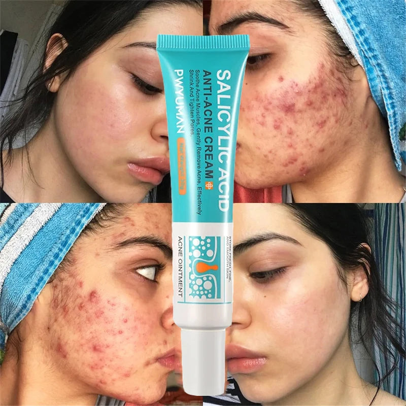 SALICYLIC ACID ANTI-ACNE CREAM SPF 15