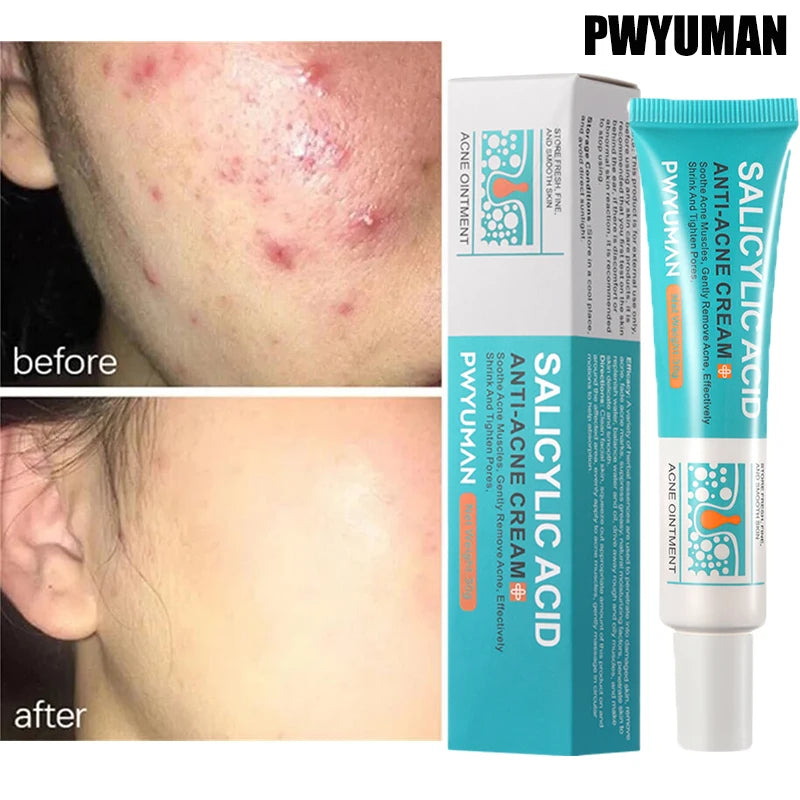 SALICYLIC ACID ANTI-ACNE CREAM SPF 15